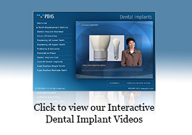 dental implants launch button
