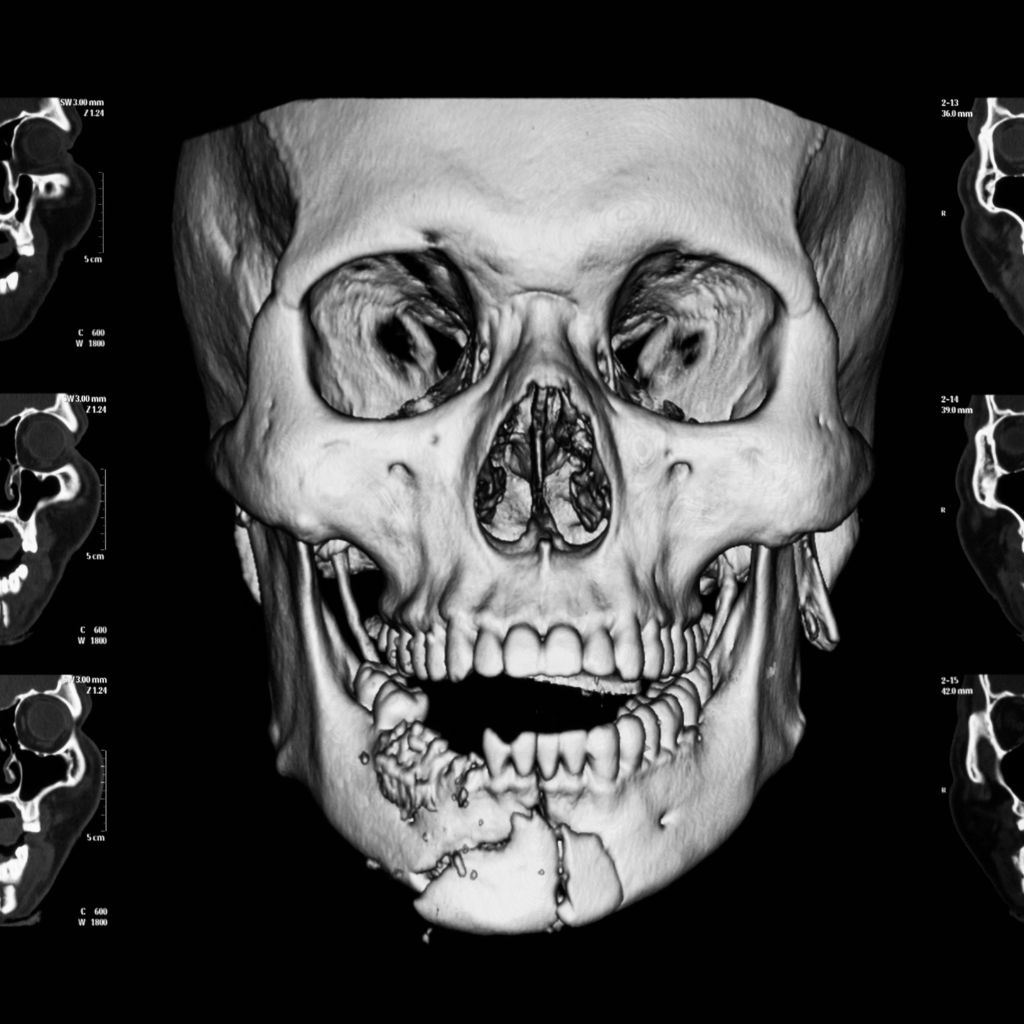 image of a facial trauma