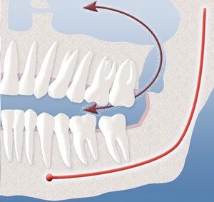 sinus communication