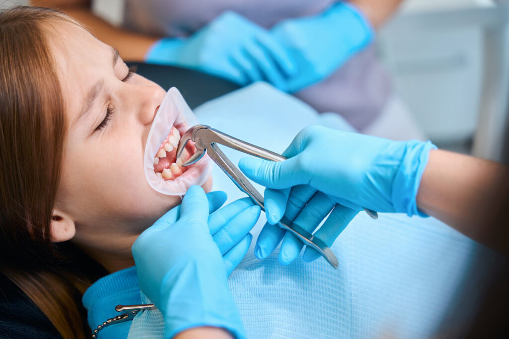 Dentist removes a girl tooth with a special tool, the girl has a dental retractor in her mouth