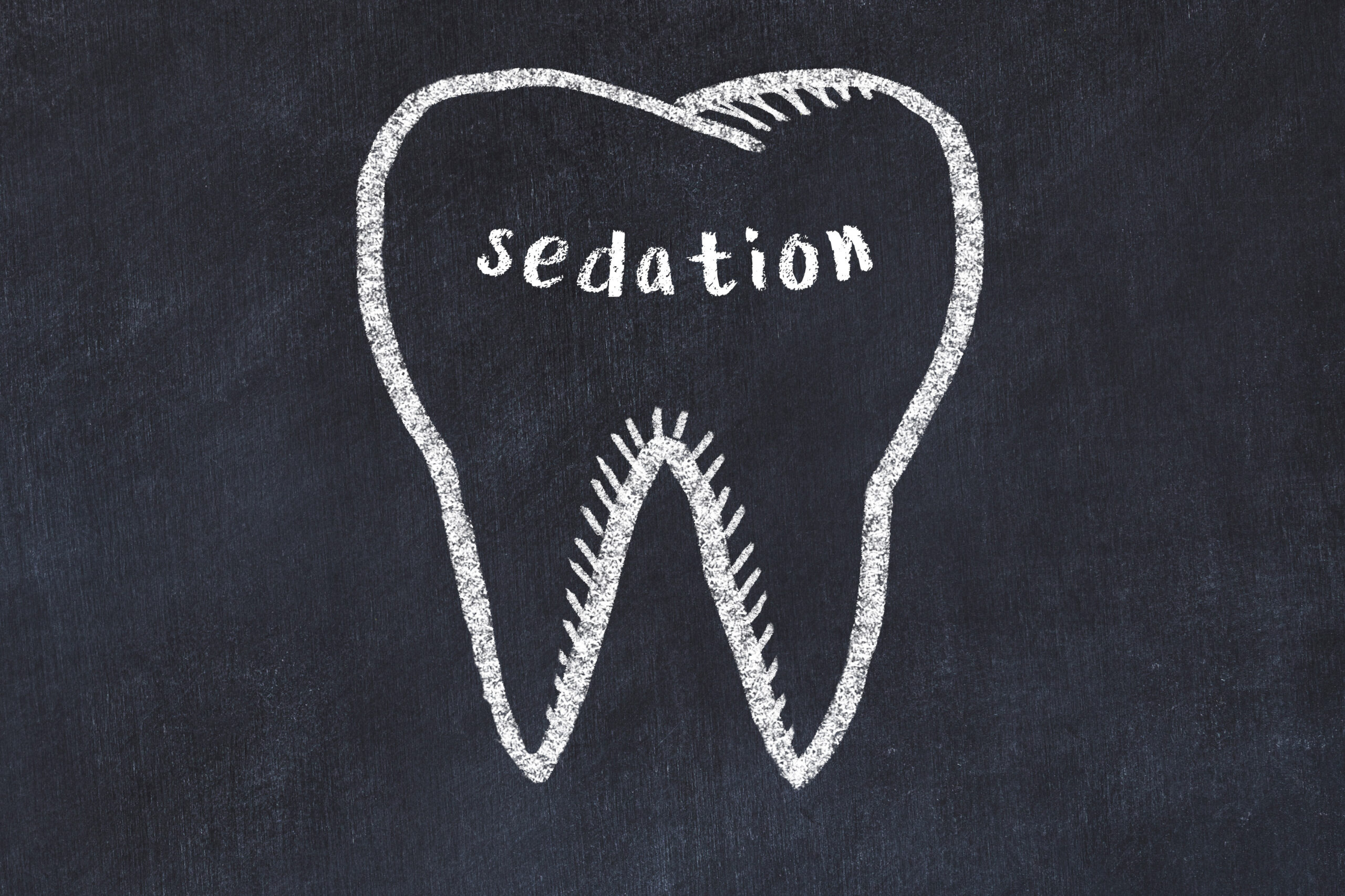 Chalk drawing of a tooth with medical term sedation. Concept of learning stomatology.